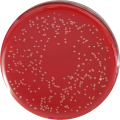 Campylobacter en agar sangre